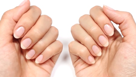 Layered nails: causes, treatment and prevention